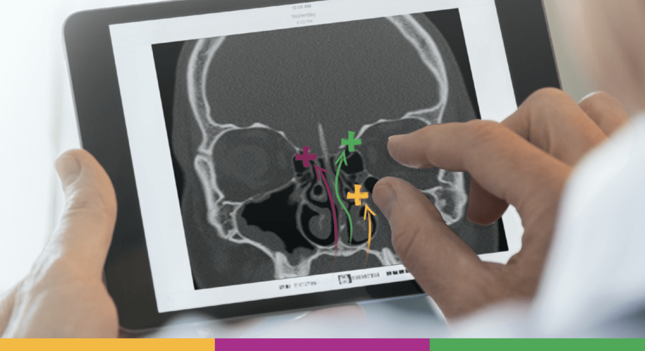 Arzt, der sich ein PROPEL-3D-Anschauungsbeispiel auf einem digitalen Gerät ansieht